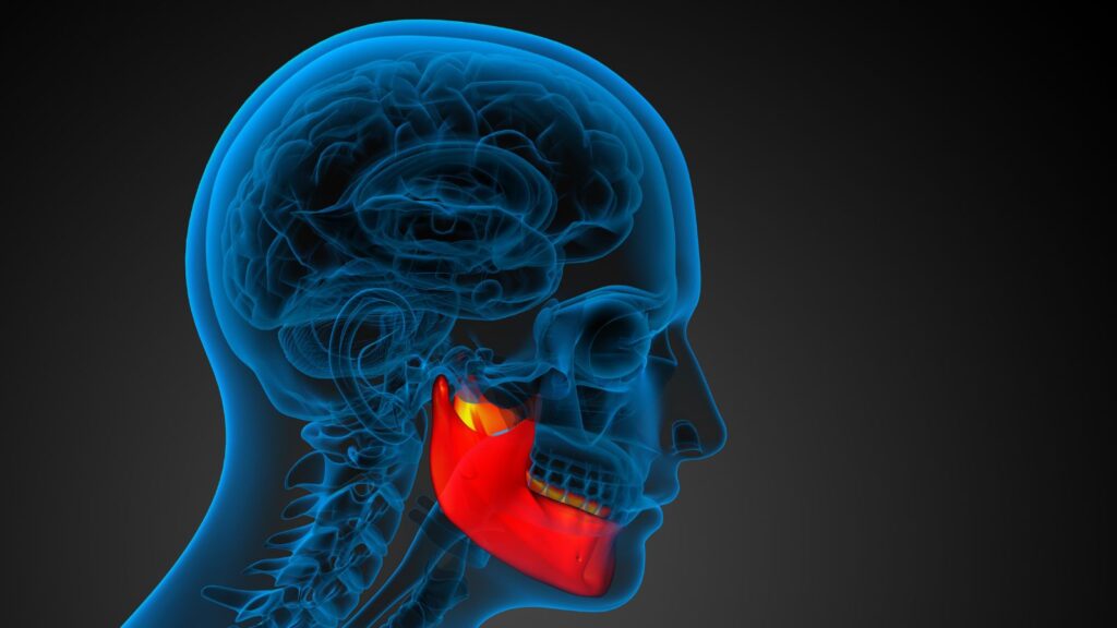 Medical illustration showing highlighted jaw area for broken jaw compensation calculator UK 2025 assessment