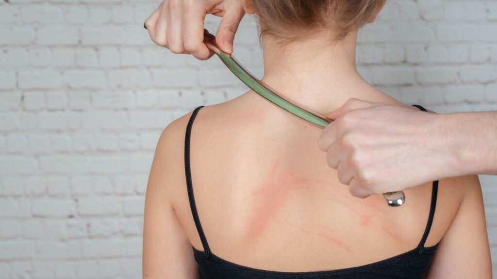 Professional scar treatment consultation representing scar compensation calculator UK 2025 assessment process