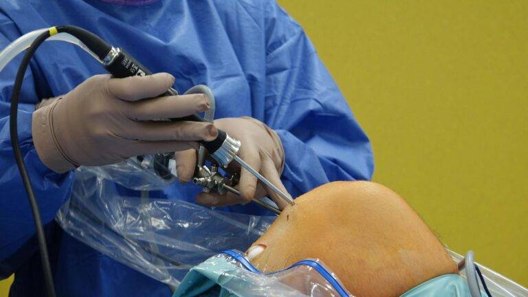 Arthroscopic knee surgery procedure showing surgical intervention for ACL tears and meniscus damage representing knee injury compensation UK 2026 medical evidence requirements