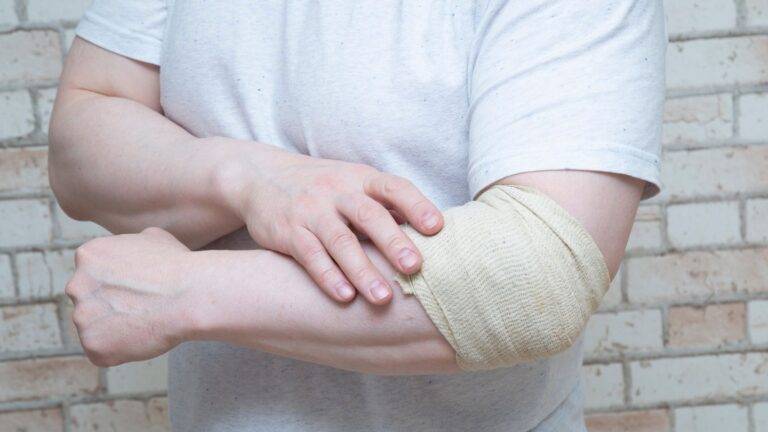 Professional elastic compression bandage treatment applied to forearm and wrist area showing medical intervention for elbow injury compensation UK 2026 treatment cost documentation