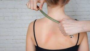 Clinical scar assessment showing measurement of visible shoulder scarring for medical evidence documentation in scar compensation UK 2025 legal claims