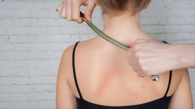 Clinical scar assessment showing measurement of visible shoulder scarring for medical evidence documentation in scar compensation UK 2026 legal claims
